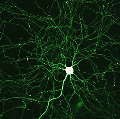 Neuron under the microscope — how nicotine works in the brain